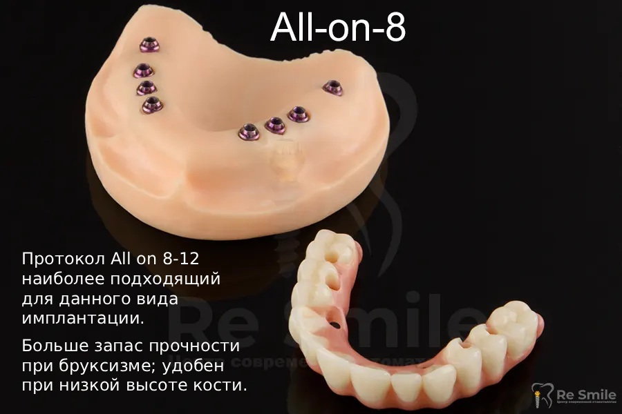 Подробнее о процедуре