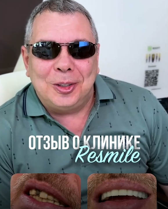 Восстановление эстетики передних зубов